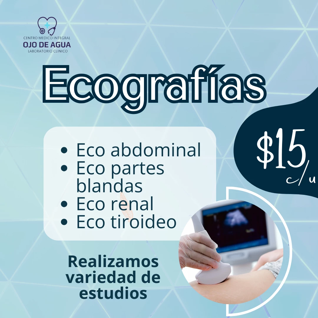 Ecografías